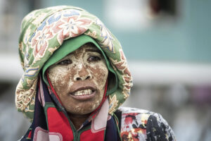 Malaysia, Denawan island, 2024-05-09. Bajau woman with her protective mask in front of her stilt house in a Bajau villag