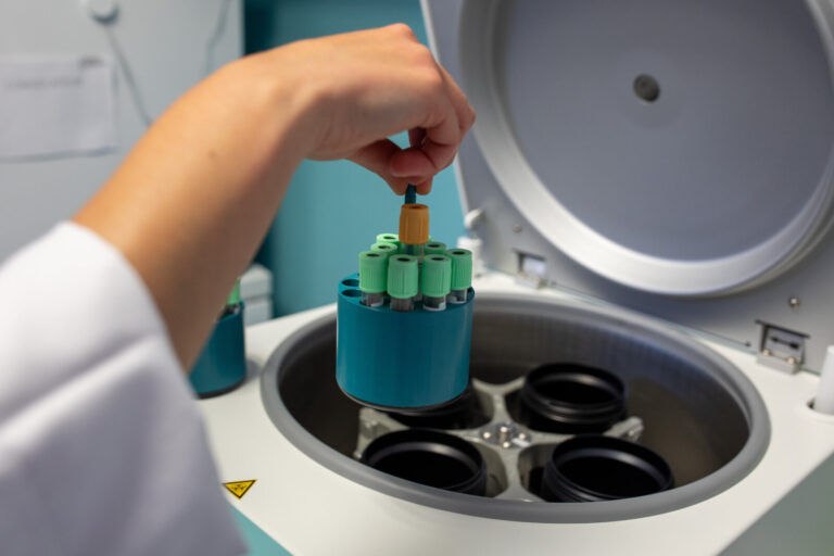 France, Lille, 2020-05-20. Illustration of the activity of a laboratory performing specific serological tests for covid1